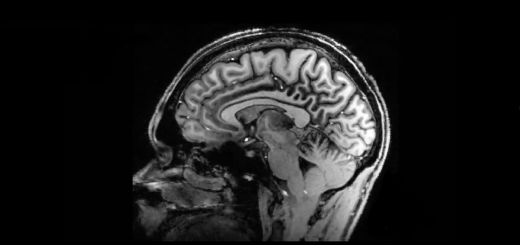 Scan image of human brain